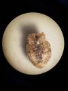 Gibbaranea bituberculata