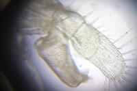 Proasellus meridianus